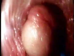 Kilo Sex presents: Video from the inside of a vagina... very interesting